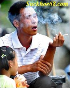 CĐN-Tổng LĐLĐ Việt Nam triển khai Luật và Chiến lược quốc gia phòng, chống tác hại của thuốc lá trong CNVCLĐ